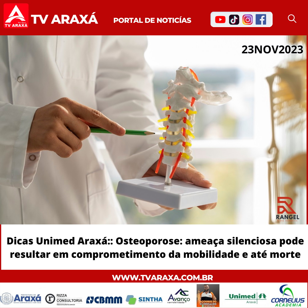 Dicas Unimed Araxá:: Osteoporose: ameaça silenciosa pode resultar em comprometimento da mobilidade e até morte