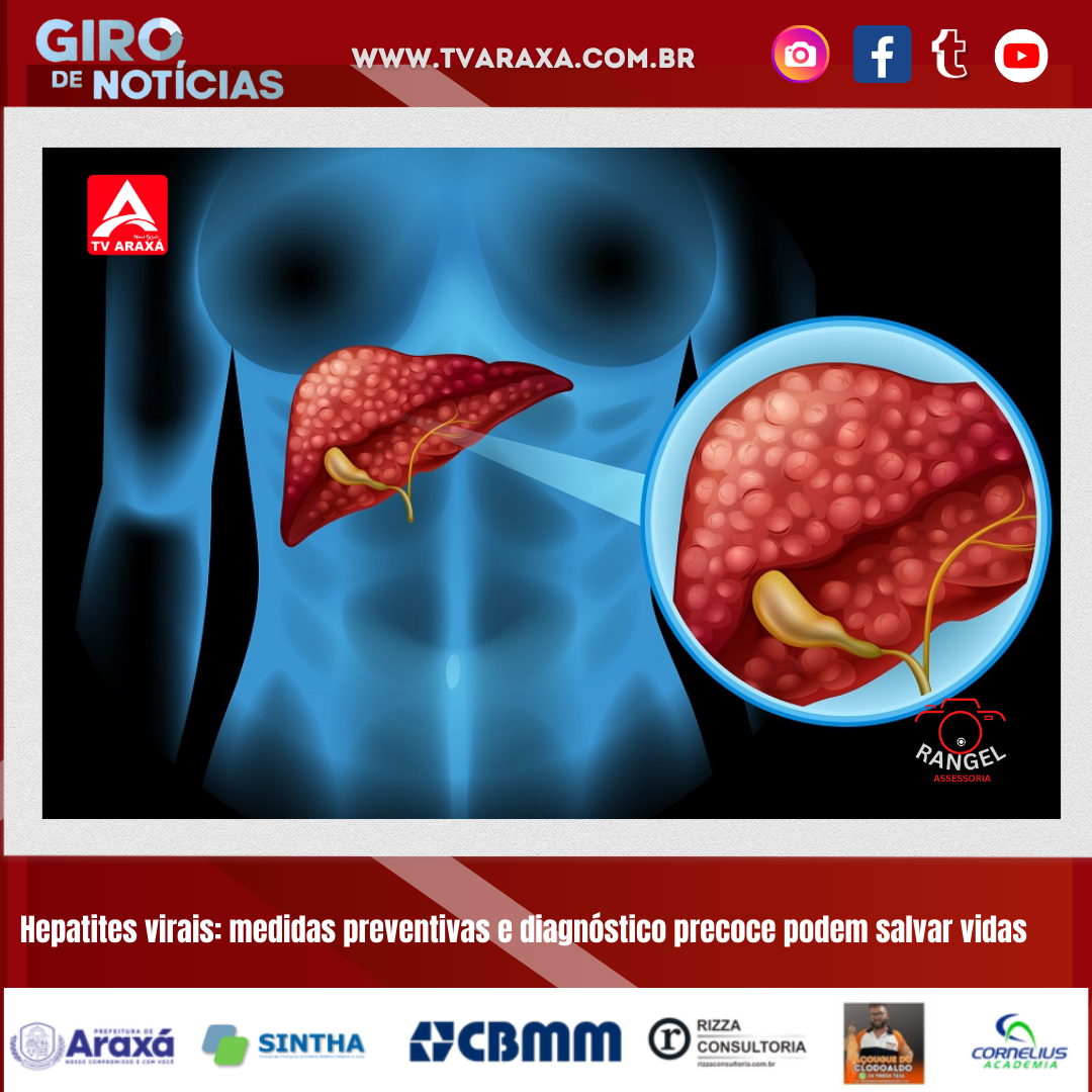 Hepatites virais: medidas preventivas e diagnóstico precoce podem salvar vidas