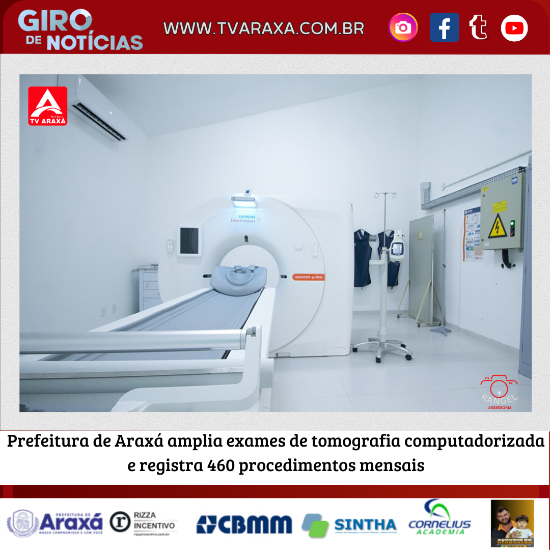 Prefeitura de Araxá amplia exames de tomografia computadorizada e registra 460 procedimentos mensais