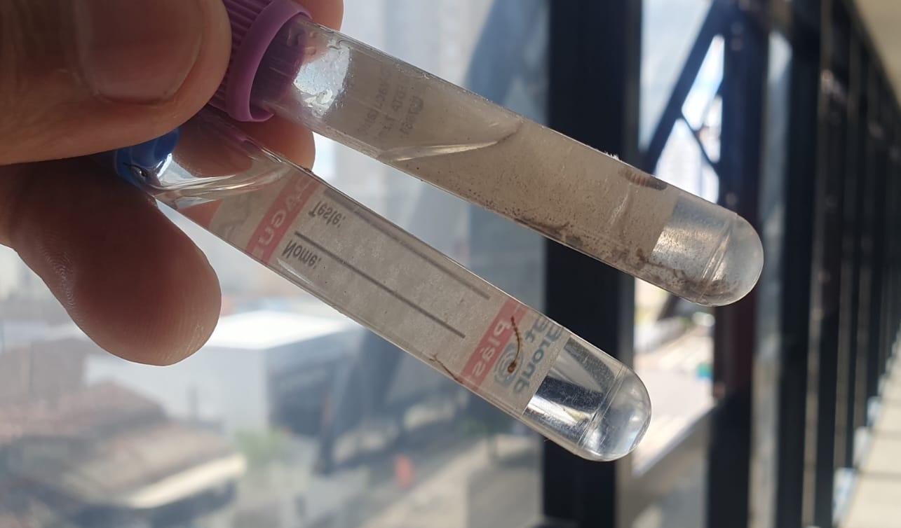 LIRAa aponta média infestação de 1%do Aedes aegypti em Araxá